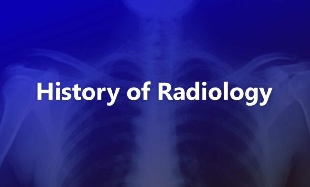 History of Radiology (X-Rays) History of Radiology (X-Rays)